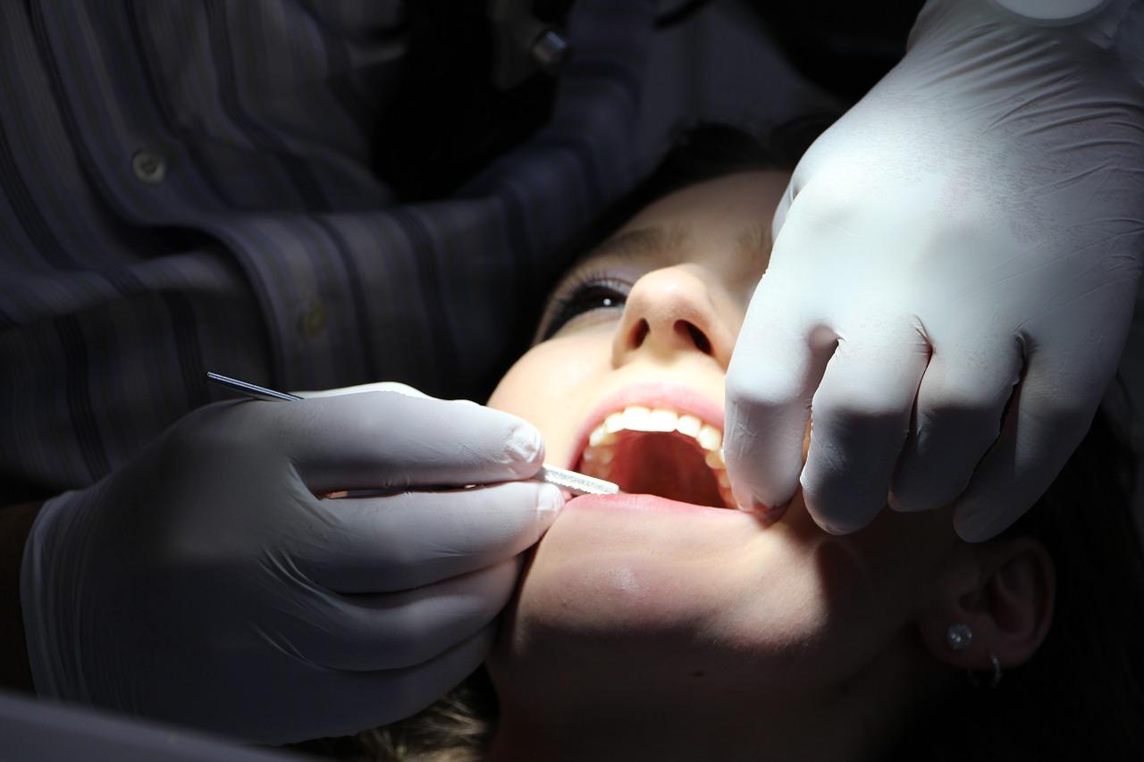 Kiedy zdecydować się na implanty zębów?