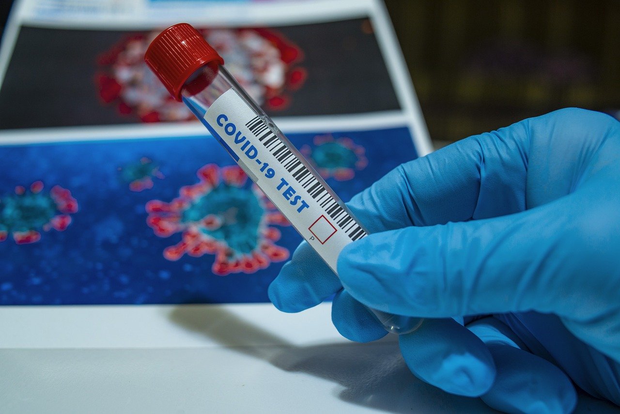 Testy używane do diagnozowania koronawirusa